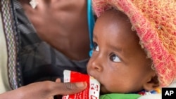 FILE - A child held by his mother eats emergency food after being screened for malnutrition in Debub Health Centre in Wajirat woreda in Southern Tigray in Ethiopia, July 19, 2021.