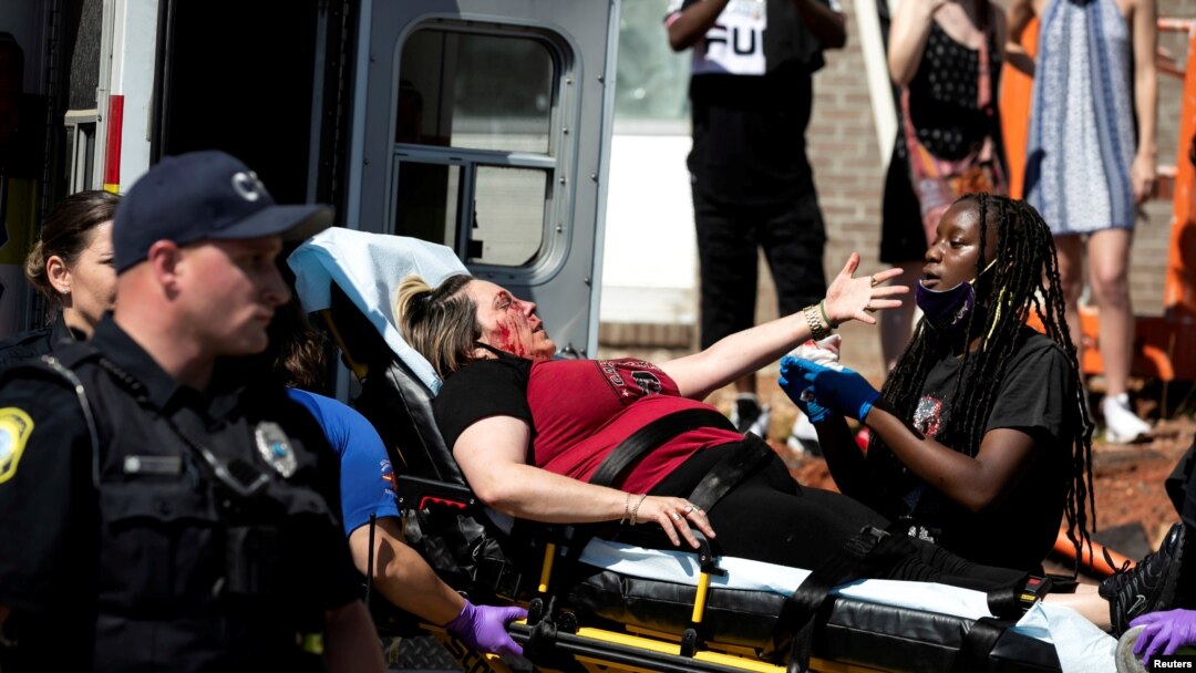 An injured protester is attended to during a rally against the death in Minneapolis police custody of George Floyd, in Columbia, S.C., May 30, 2020. 