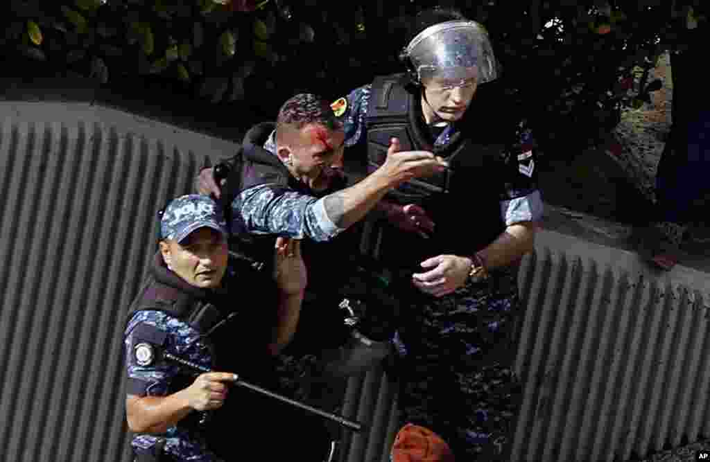 An injured police officer shouts during a protest in Beirut, Lebanon, as the government faces a financial crisis.