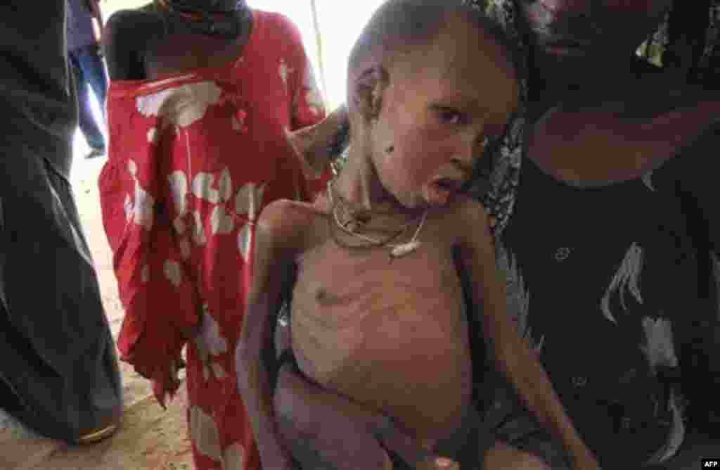 Four-year-old Said Nor, a malnourished child from southern Somalia sits in camp in Mogadishu Somalia Thursday July, 28, 2011. Heavy fighting erupted Thursday in Somalia's capital as African Union peacekeepers launched an offensive aimed at protecting fami