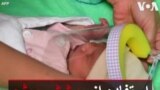 استفاده از پوشش ویژه برای محافظت از نوزادان در برابر کرونا