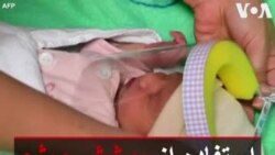 استفاده از پوشش ویژه برای محافظت از نوزادان در برابر کرونا