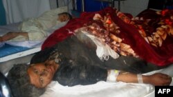 16일 아프가니스탄 서부 파라주 도로변 폭탄 테러로 부상을 입은 민간인. 