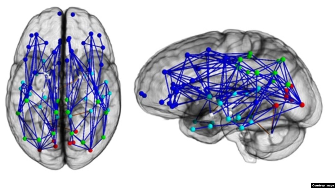 Brain networks show increased connectivity in males and females.(University of Pennsylvania)