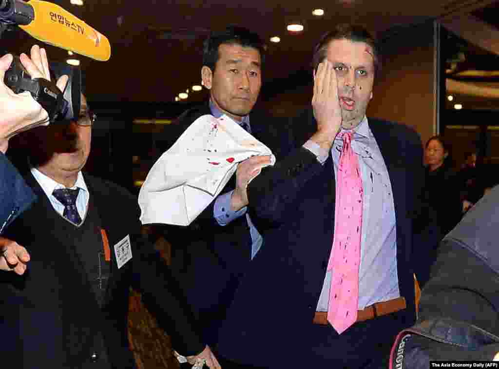U.S. ambassador to South Korea Mark Lippert covers a slash on his face as he leaves the Sejong Cultural Institute in Seoul, after he was attacked by an armed assailant, in Seoul, March 5, 2015.