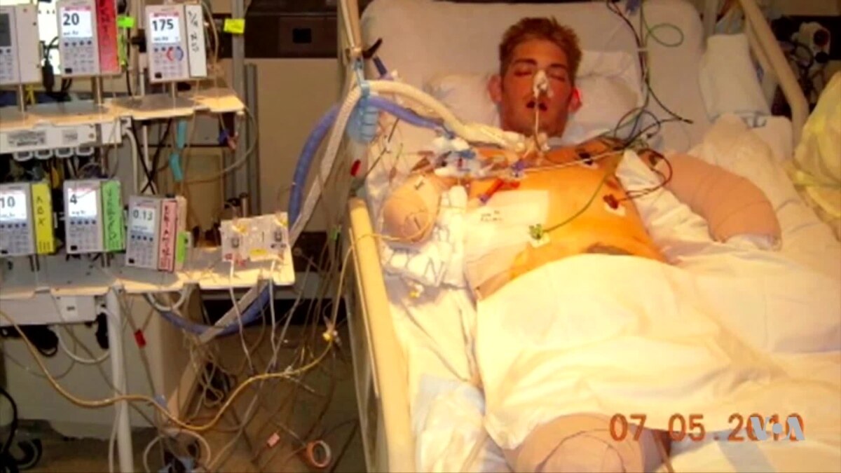 Double Arm Transplant Gives Former US Soldier a New Life