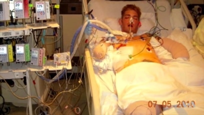 Double-arm transplant gives marine corps veteran a shot at new life (voanews.com)