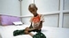 جنگ یمن: سایه سیاه مرگ در کمین بیش از یک میلیون کودک قحطی زده