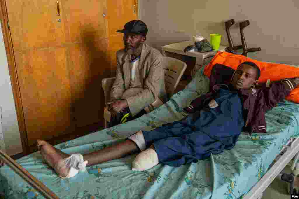 A boy, accompanied by his father, recovers from an amputation in the Ayder Referral Hospital on June 4, 2021, in Mekelle, Ethiopia. He lost his lower leg after being hit by artillery fire.