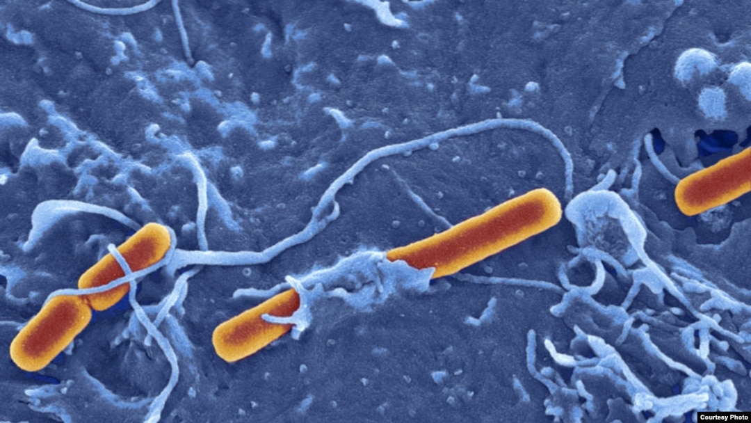 Bakteri Shigella Sonsei penyebab disentri. (Foto: Dave Goulding)
