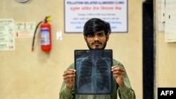 This photograph taken on November 4, 2024 shows patient Balram Kumar holding his chest x-ray at a special pollution clinic in the government-run Ram Manohar Lohia hospital of New Delhi.