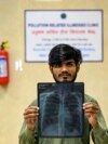 This photograph taken on November 4, 2024 shows patient Balram Kumar holding his chest x-ray at a special pollution clinic in the government-run Ram Manohar Lohia hospital of New Delhi.