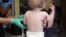 Eczema Treatment During Infancy Helps Prevent Asthma, Allergies