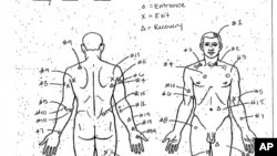 El diagrama de la autopsia de Laquan McDonald, de 17 años, quien fue baleado 16 veces por un policía de Chicago en 2014.