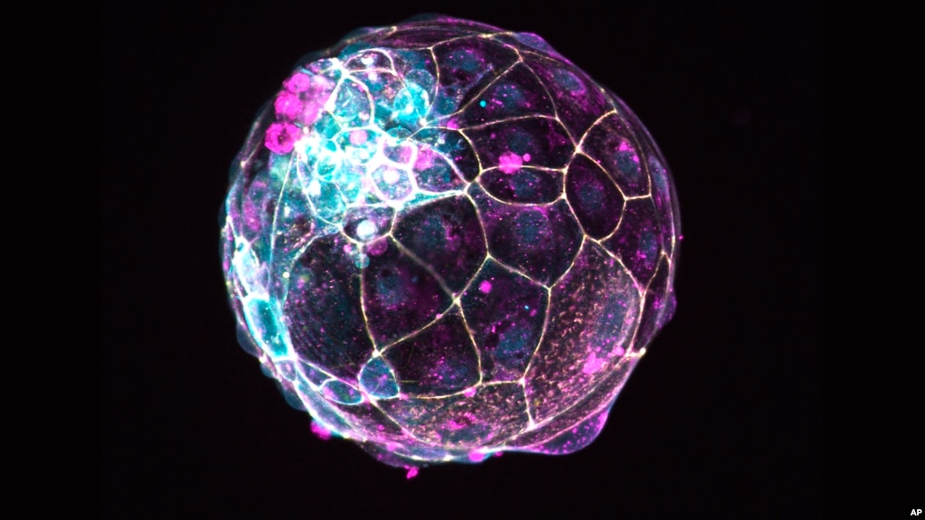 This image, provided by the Institute of Molecular Biology of the Austrian Academy of Sciences, shows a human “blastoid” created in a lab. (Photo by Alok Javali, Heidar Heidari and Theresa Sommer/Institute of Molecular Biology of the Austrian Academy of Sciences via AP)