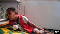 Abel Guesh, 8, rests at the Ayder Referral Hospital in the Tigray capital, Mekelle, on Feb. 25, 2021, after being injured during the fighting in Ethiopia.