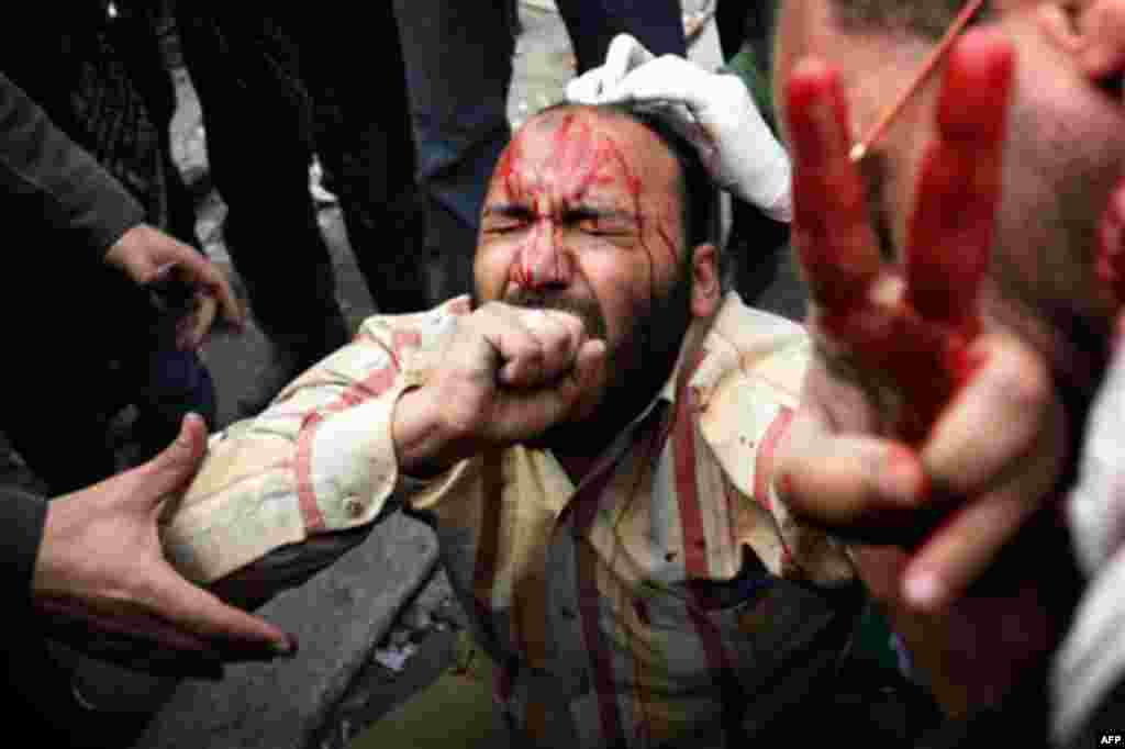 A wounded anti-government protestor is tended during clashes in Cairo. Gangs of thugs supporting President Hosni Mubarak attacked reporters, foreigners, and human rights workers and the army rounded up foreign journalists on Thursday. (Sebastian Scheiner/