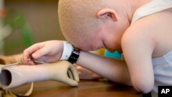 FILE- Mwigulu Matonange Magesa pauses for a moment after an occupational therapy session, Aug. 25, 2015, at Shriners Hospital for Children in Philadelphia. Mwigulu was in the U.S. to receive free surgery and prostheses at the hospital. 