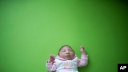 Seorang bayi yang lahir dengan mikrosepali yang diduga disebabkan oleh virus Zika.