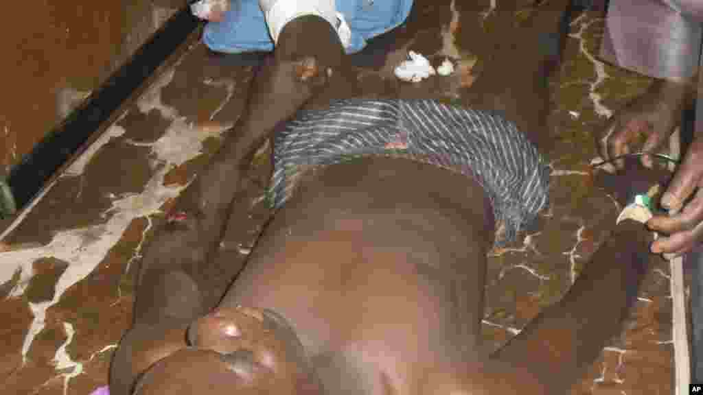 Ana jinyar wadanda suka ji rauni a babban Asibitin Potiskum, wanda yake dab da MKakarantar Sakandaren Kimiyya ta Gwamnati inda a yau Litinin 10 Nuwamba 2014 wani dan kunar-bakin-wake ya kai harin bam