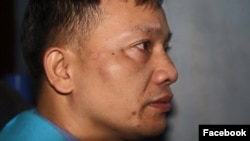Luật sư Nguyễn Văn Đài sau khi bị tấn công (Ảnh: Facebook).