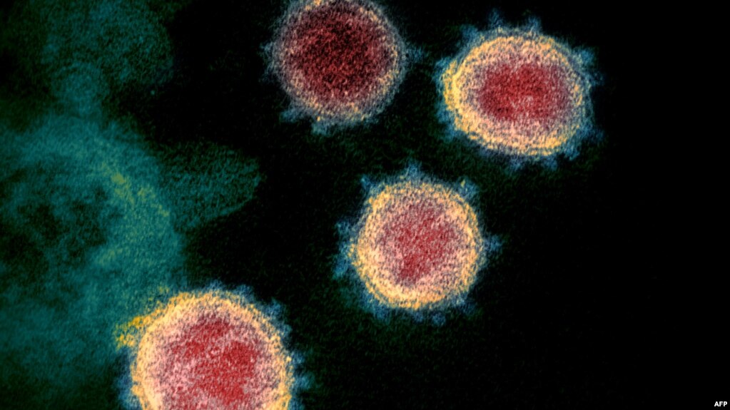 电子显微镜图像显示的新冠病毒(photo:VOA)