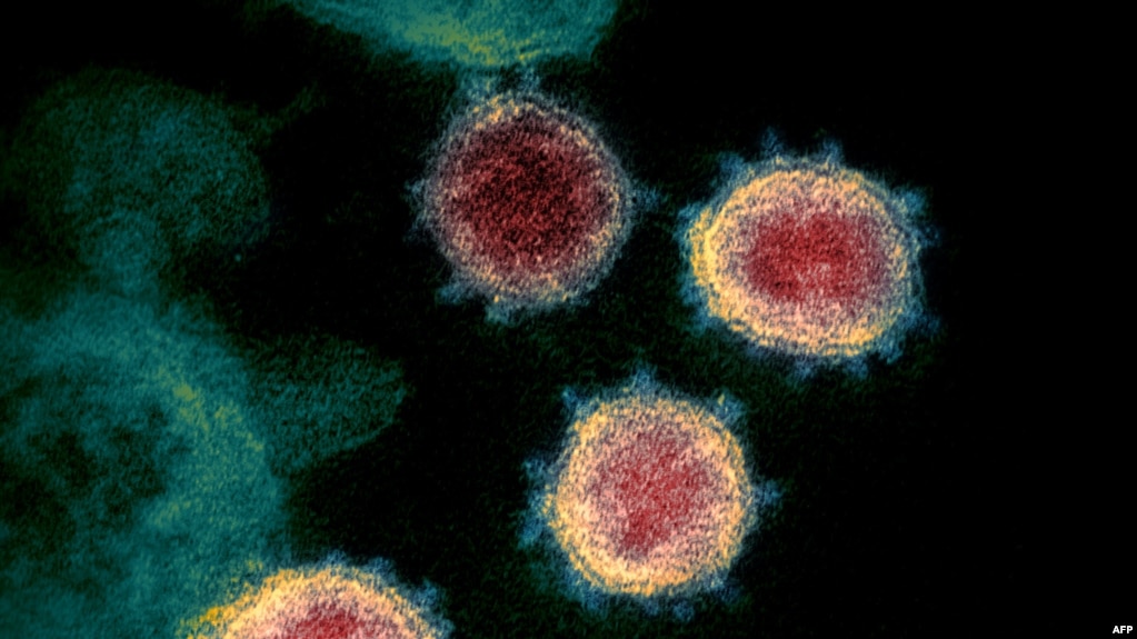 电子显微镜图像显示的新冠病毒(photo:VOA)