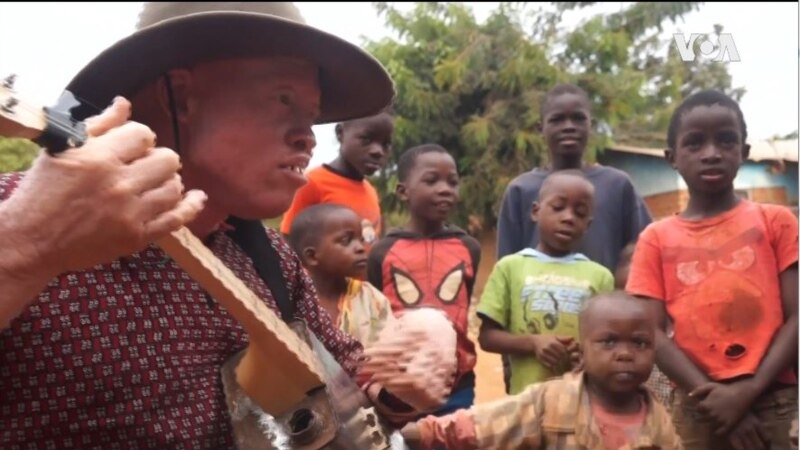 Musisi Malawi Tangkal Mitos Tentang Albino mastermedia.co.id