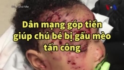 Dân mạng góp chục ngàn đô giúp chú bé bị gấu mèo tấn công 