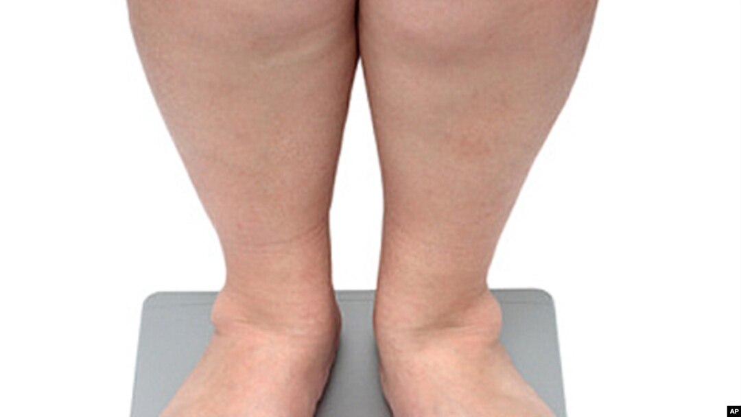 Research in gastric bypass surgery could lead to new treatments for diabetes.