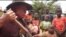 Lazarus Chigwandali, pria albino di Malawi, menyuarakan cara mengatasi diskriminasi dan pemahaman keliru mengenai kondisi genetik melalui musik. (Photo: videograb)