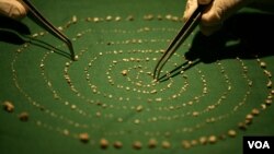 Para dokter menyusun gigi-gigi yang dicabut dari mulut anak laki-laki berusia 7 tahun di sebuah rumah sakit di Chennai, India, 2 Agustus 2019.(Foto: Reuters)