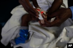 FILE - A doctor puts a heart monitor on the foot of a baby who is suffering from severe malaria in the Siaya hospital in western Kenya.