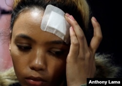 FILE - Gabriella Engels touches her head during a media conference in Pretoria, South Africa, Aug. 17, 2017.