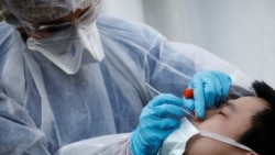 ကမ္ဘာတဝှမ်း ကုလဝန်ထမ်း ၈၆ ယောက် ကိုရိုနာဗိုင်းရပ်စ် ကူးစက်ခံရ