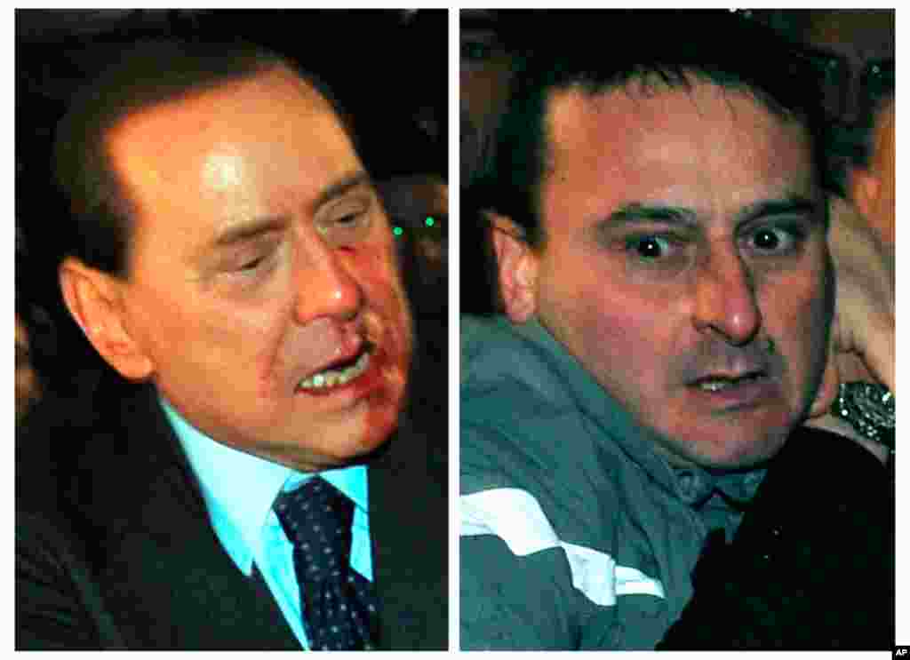 He was taken to a Milan hospital with blood smeared over his face after a small model of Milan cathedral was hurled at him at a political rally. (REUTERS/Livio Anticoli)