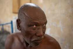 Gebremedhin Gebru, 65-year-old farmer and Tigrayan survivor from Ruwasa, Ethiopia, shows his wounds at the Hamdayat Transition Center near the Sudan-Ethiopia border, eastern Sudan, Dec. 15, 2020.