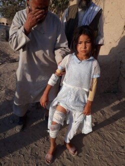 Masuda Ozbek, 10, was injured in the mortar attack that left her twin sister dead in Afghanistan last year. (Photo courtesy of her father, Abdul Kareem Ozbek)