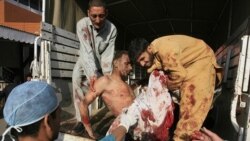 A man who is injured in a twin suicide bomb in Charsadda, is carried out from a vehicle after being brought to Lady Reading hospital in Peshawar