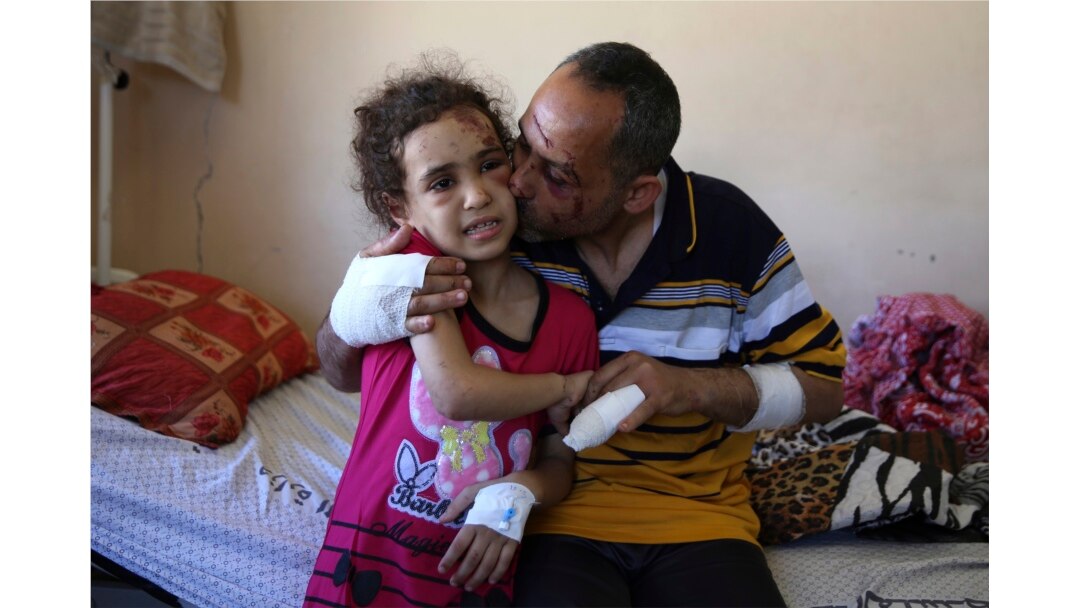 Suzy Ishkontana, 7 tahun, dicium ayahnya, Riad Ishkontana, 42, di Rumah Sakit Shifa di Kota Gaza, Selasa, 18 Mei 2021. (Foto: AP/Abdel Kareem Hana)