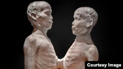 Death cast of "Siamese Twins" Chang and Eng Bunker. (George Widman/Mütter Museum)