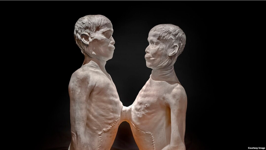 Mütter Museum Showcases Medical Monstrosities