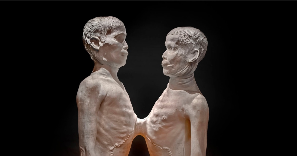 The Mutter Museum Of the College of Physicians of