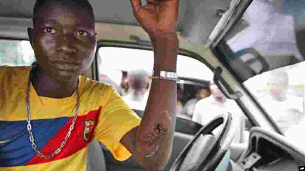A Nigerien young man injured in an immigration raid shows his wounds at Katangua Market in Lagos.