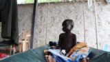 A South Sudanese child suffering from cholera sits on a bed in Juba Teaching Hospital in Juba, May 27, 2014. 