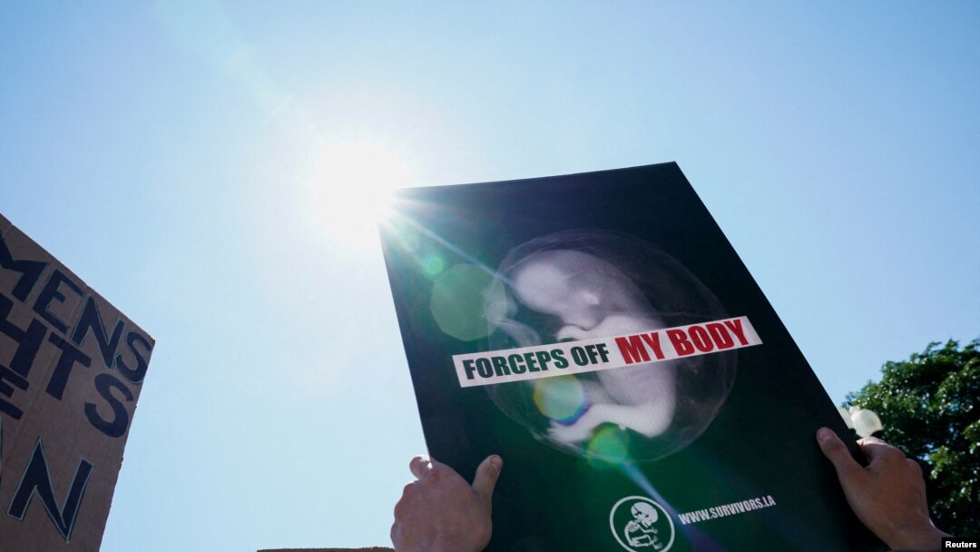 Un manifestante a favor del fallo muestra un cartel que expresa "fórceps, lejos de mi cuerpo", frente a la Corte Suprema, en Washington DC, el 25 de junio de 2022.
