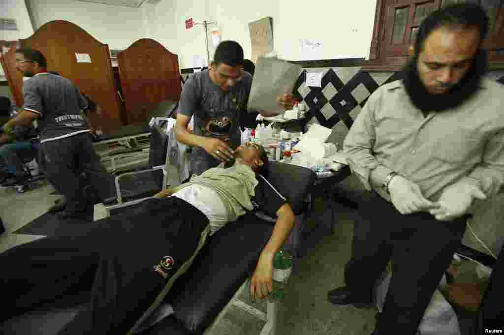 A wounded supporter of deposed Egyptian President Mohamed Morsi lies at a private hospital in Cairo, July 8, 2013.