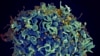 Ảnh chụp bằng kính hiển vi điện tử của Viện Y tế Quốc gia Mỹ cho thấy một tế bào T của con người màu xanh, bị virus HIV màu vàng tấn công. Ba phụ nữ được chẩn đoán nhiễm HIV sau khi làm trẻ hóa da mặt tại một tiệm spa không có giấy phép ở New Mexico.