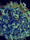 Ljudska ćelija pod napadom virusa HIV (Foto: Seth Pincus, Elizabeth Fischer, Austin Athman/National Institute of Allergy and Infectious Diseases/NIH via AP)