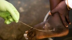 Health Chat: Eradicating Guinea Worm Disease 